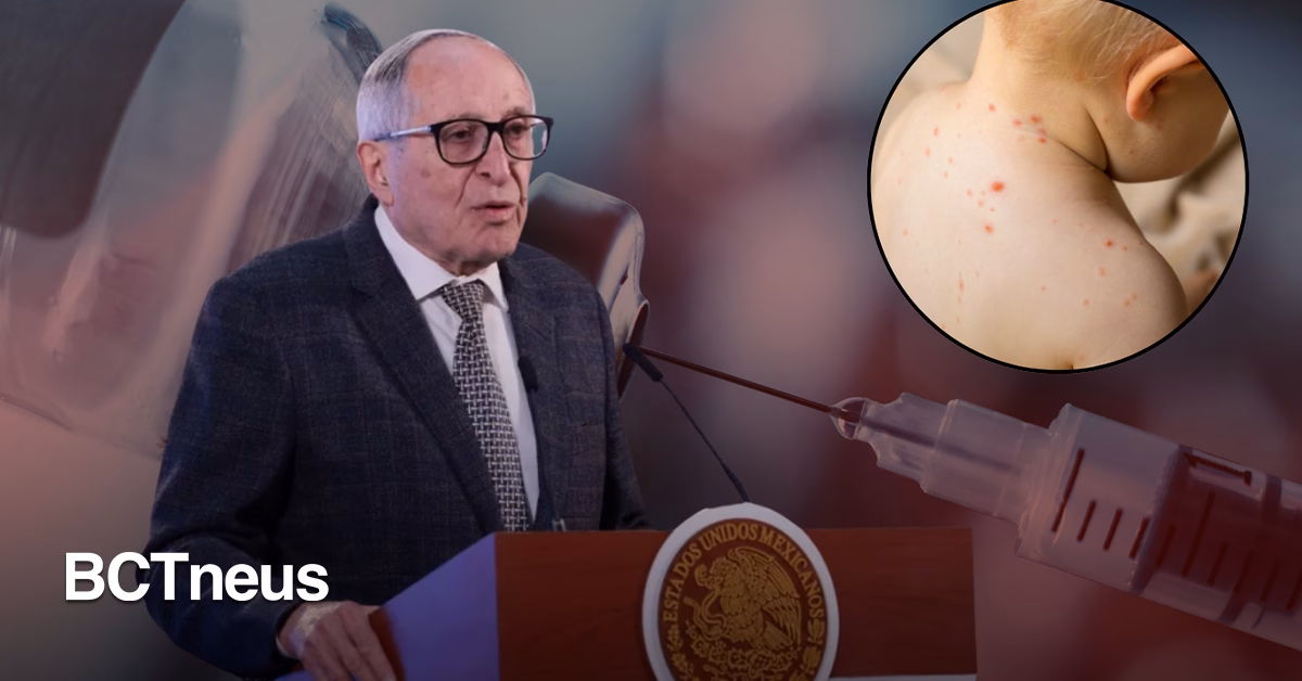 Articulo - México refuerza estrategia contra el sarampión; 4 mil 353 casos confirmados